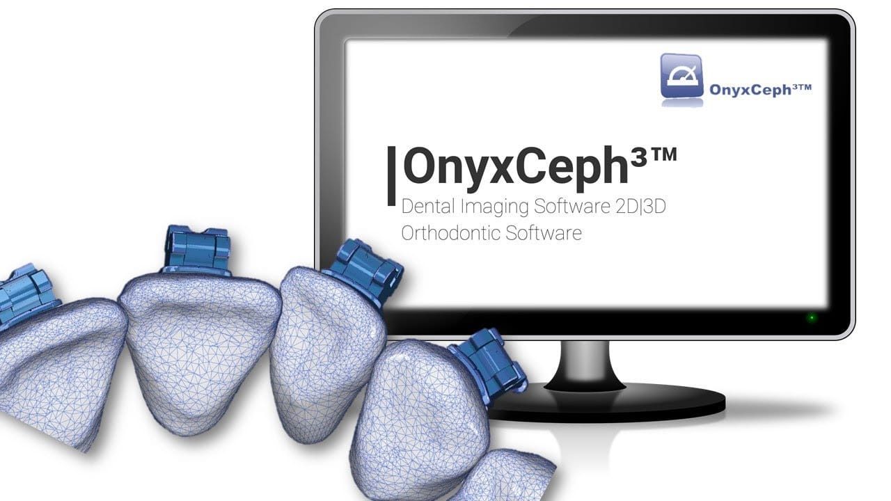 Onyx Ceph 4.1.9 Crack With Download 2023